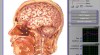 Oberon-diagnostika zdravotního stavu 265000_t.jpg