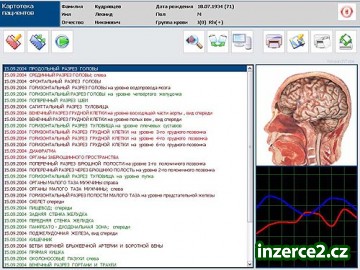 1A - špičkové vyšetření NLS diagnostikou METATRON Hunter_2 111924_2.jpg