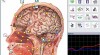 1A - špičkové vyšetření NLS diagnostikou METATRON Hunter 111924_t.jpg