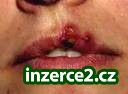 Máte kožní či alergické problémy?_1 187201_1.jpg
