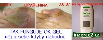Naražený palec a OK Gel_2 19391_2.jpg