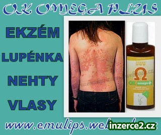 Lupénka,ekzém,akné,cévy-OK Omega+_1 241628_1.jpg