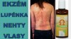 Lupénka,ekzém,akné,cévy-OK Omega+ 241628_t.jpg