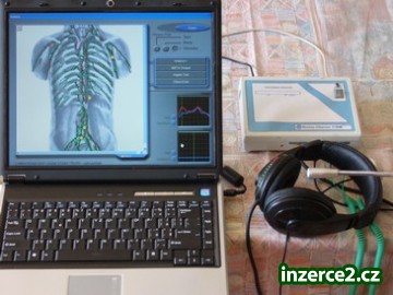 Oberon- diagnostický a terapeutický přístroj_1 255488_1.jpg