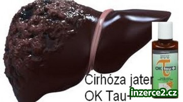 Pomůže při CIRHOZE JATER_1 418402_1.jpg