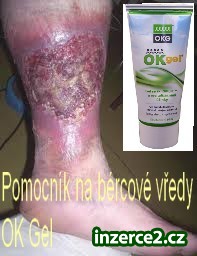 Nevíte jak na otevřené BÉRCOVÉ VŘEDY?_1 418482_1.jpg