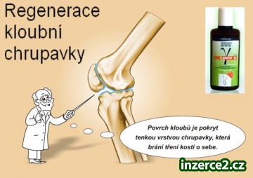 Pro zdravou KLOUBNÍ CHRUPAVKU. Nebudete litovat_1 418498_1.jpg