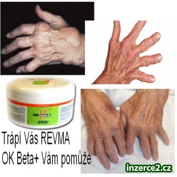 Trápí Vás REVMA?_1 418502_1.jpg