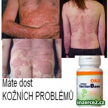 Trápí Vás KOŽNÍ PROBLÉMY?_1 418512_1.jpg