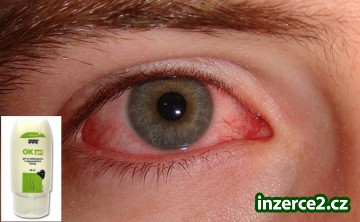 ZÁNĚT SPOJIVEK, ZÁNĚT UŠÍ_1 418541_1.jpg