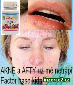 Trápí Vás AKNÉ, AFTY, OPARY možnost 40% Slevy_1 418545_1.jpg