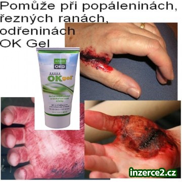 Užásný pomocník na POPÁLENINY, ODŘENINY, ŘEZNÉ RÁN_1 419544_1.jpg