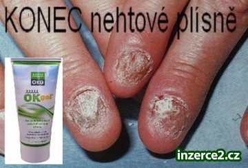 Nevíte jak na NEHTOVOU PLÍSEŇ?_1 422643_1.jpg