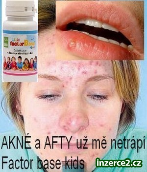 Trápí Vás AKNÉ, AFTY_1 423461_1.jpg