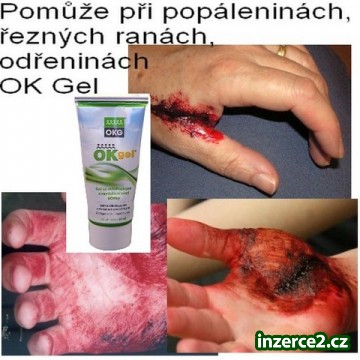 Užásný pomocník na POPÁLENINY, ODŘENINY, ŘEZNÉ RÁNY_1 423790_1.jpg
