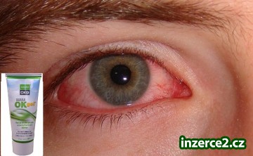 ZÁNĚT SPOJIVEK, ZÁNĚT UŠÍ_1 424813_1.jpg