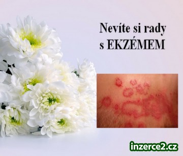Nevíte si rady s EKZÉMEM?_1 482952_1.jpg