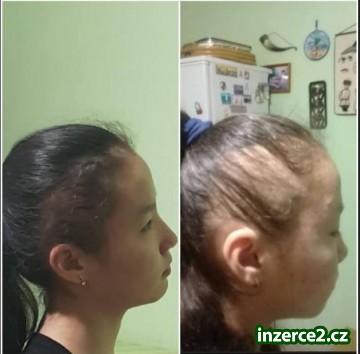 Zdraví a přivýdělek v jednom_1 516314_1.jpg