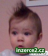 Zbavte se ekzému!_1 72603_1.jpg