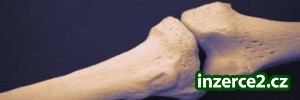 PREVENCE OSTEOPORÓZY-rekondice!_1 72818_1.jpg